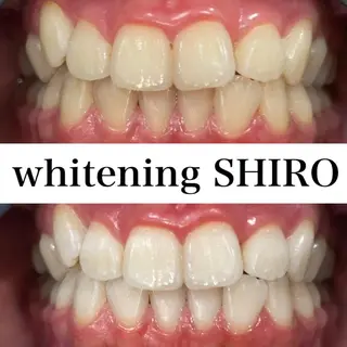 福岡ホワイトニング SHIRO天神店のエステ・リラクイメージ
