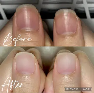 ネイル 深爪・自爪育成専門 MAHALOHIのネイルデザイン