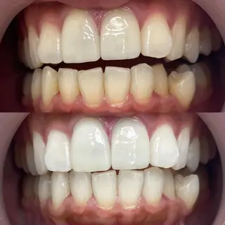 LBSホワイトニング 銀座店💎スタッフ峯のその他イメージ