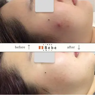 毛穴専門店Bébé 大阪中央店のエステ・リラクイメージ