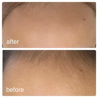 YOLO 梅郷店所属・YOLO痩身/脱毛 🌼MARI🌼のエステ・リラクイメージ