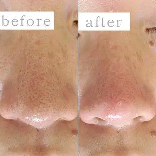 毛穴専門サロン　フルール所属・フルールFululu 自由が丘のエステ・リラクイメージ