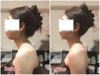 首肩こり専門サロン Kalnicco/カルニッコ所属・首肩こり専門サロン Kalniccoのエステ・リラクイメージ