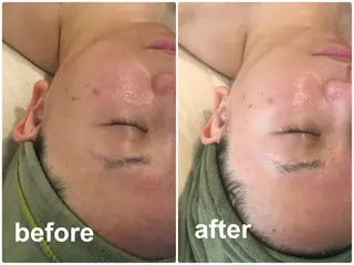 ブライダルエステ専門 入谷友莉のエステ・リラクイメージ