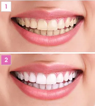 vi viのヘアスタイル