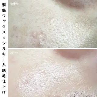 Muqu.所属・Muqu. 毛穴サロンのエステ・リラクイメージ