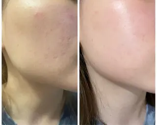 小顔/たるみ/黒ずみ除去専門サロン/SONA 大和西大寺店所属・【小顔専門看護師 サロンSONA】のエステ・リラクイメージ