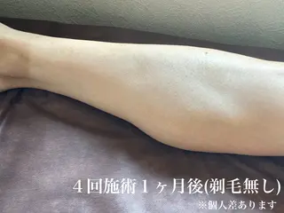 muumo所属・muumo まりののエステ・リラクイメージ