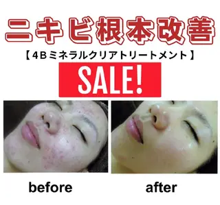 mindplus(マインドプラス)所属・mind plus 【小顔　痩身　脱毛】のエステ・リラクイメージ