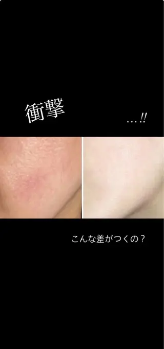 半田市エステサロン　シェソワ所属・肌荒れ/疲れケア シェソワのエステ・リラクイメージ