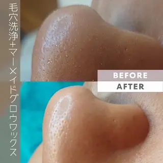 夏秋美肌サロン所属・毛穴改善フェイシャル 夏秋美肌サロンのエステ・リラクイメージ