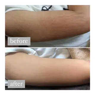 美肌脱毛専門サロン Dione栄店のエステ・リラクイメージ