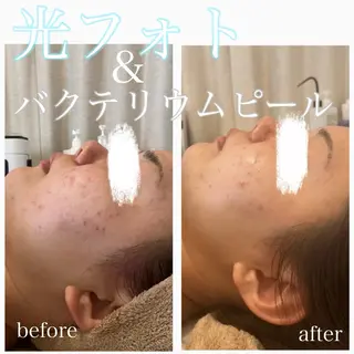 美肌脱毛と癒しのﾌﾟﾗｲﾍﾞｰﾄｻﾛﾝ。gratia~ｸﾞﾚｲﾃｨｱ~所属・gratia ~ｸﾞﾚｲﾃｨｱ~のエステ・リラクイメージ