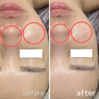 ReN所属・ReN エステサロンのエステ・リラクイメージ