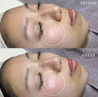 フェイシャルワックス KANAKOのエステ・リラクイメージ