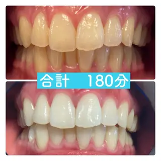 PLATINUM Beauty 横浜店所属・ホワイトニングルーム 横浜店のその他イメージ