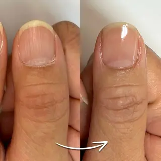 ネイル Tolano nailcareのネイルデザイン