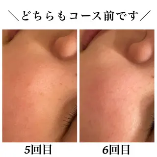 Bellesthe （ベルエステ）のエステ・リラクイメージ