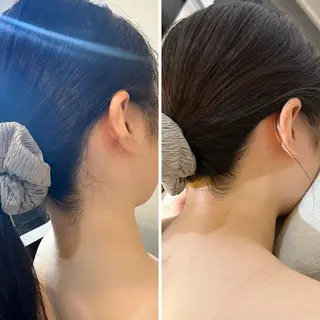 うなじ脱毛/美肌脱毛 LABELのエステ・リラクイメージ