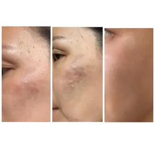 skin make salon -Olu's-所属・毛穴・肌質改善サロン ✨Tomaのその他イメージ