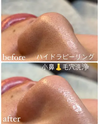 sourire.11 ‪☺︎‬‪emiのエステ・リラクイメージ