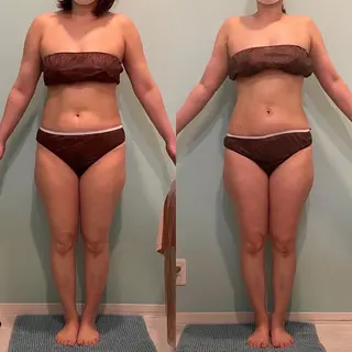 Nature（ナチュレ）所属・【脳洗浄/痩身】 nature東金のエステ・リラクイメージ