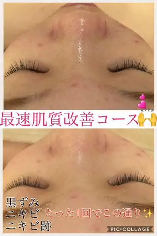 ショート カラー パーマ ヘアアレンジ メンズ キッズ ネイル マツエク・マツパ ニキビ・肌質改善専門 ♡人生が変わるサロンのエステ・リラクイメージ