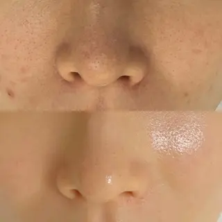 メンズ キッズ 親子脱毛サロンReOlu所属・親子脱毛サロン ReOluのエステ・リラクイメージ