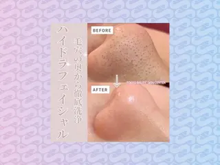 毛穴洗浄& 睫毛パーマ上野御徒町のマツエク・マツパデザイン