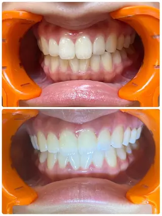 ベルーテ エッセンスのエステ・リラクイメージ