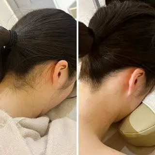 うなじ脱毛/美肌脱毛 LABELのエステ・リラクイメージ