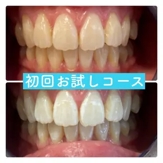 PLATINUM Beauty 横浜店所属・ホワイトニングルーム 横浜店のその他イメージ