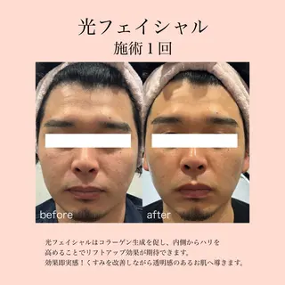 【結果が出る肌管理】 Ryanのエステ・リラクイメージ