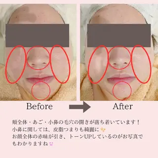 PRETTIEST SHINE所属・フェイシャル/ボディ /ブライダル山田浩子のエステ・リラクイメージ