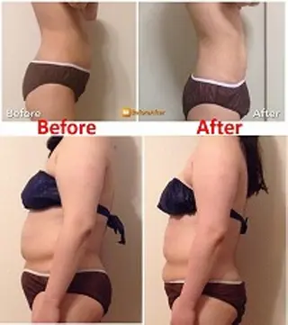 小尻・太もも痩せる エステルナボーテのエステ・リラクイメージ