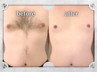 都度払い 脱毛 Lino柏/moeのエステ・リラクイメージ