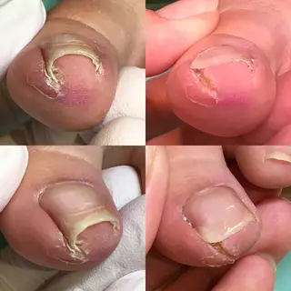 ネイル 東京巻き爪アカデミー所属・東京巻き爪 アカデミーのエステ・リラクイメージ