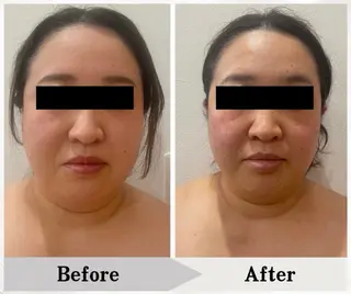 BAUM坂戸 ヘッドスパのエステ・リラクイメージ