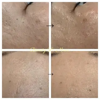 ビューティー ミロワールのエステ・リラクイメージ