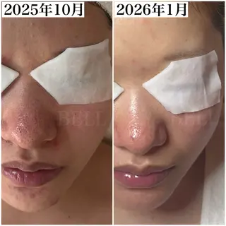 BEAUTY SALON BeLL所属・毛穴ケア専門店 BeLL ベルのエステ・リラクイメージ