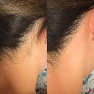 オーガニック エステ サロンフィオーレの眉毛・アイブロウイメージ