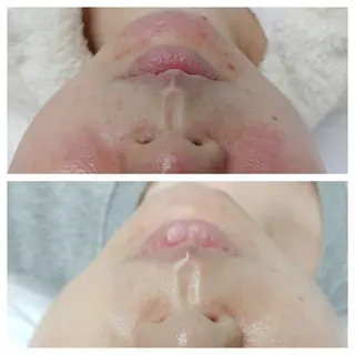 表参道鍼灸院K 美容鍼🔮ララピールのエステ・リラクイメージ