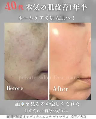 private salon  Dea_maris シュガーリング＆パーソナルボディケア所属・シミ改善・韓国肌管理 ボディメイク痩身のその他イメージ