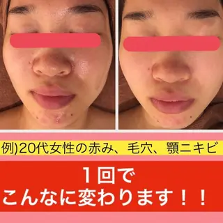 ミディアム カラー パーマ ヘアアレンジ メンズ キッズ ネイル マツエク・マツパ ニキビ・肌質改善専門 ♡人生が変わるサロンのエステ・リラクイメージ