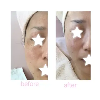 BLOOM〜 天恵（てんのめぐみ）のエステ・リラクイメージ