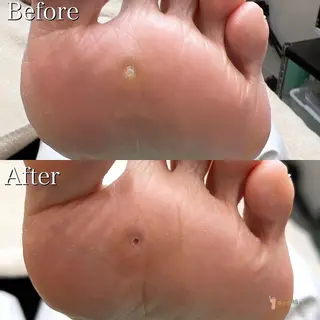 東京巻き爪アカデミー所属・東京巻き爪 アカデミーのエステ・リラクイメージ