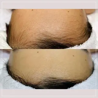 RICCO 堺東所属・RICCO 堺の眉毛・アイブロウイメージ