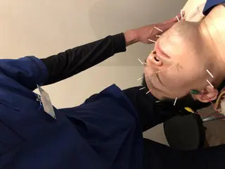 むくみたるみ専門☆ 美容鍼・小顔矯正のエステ・リラクイメージ