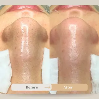 毛穴ケア特化専門店 トネア自由が丘店のエステ・リラクイメージ