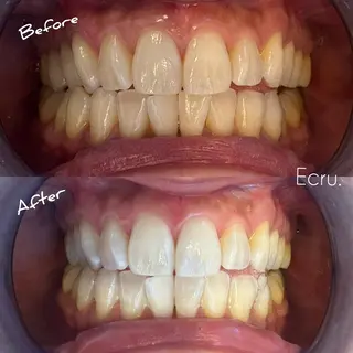 メンズ ホワイトニングサロン Ecru所属・ホワイトニングサロン Ecru エクリュのエステ・リラクイメージ